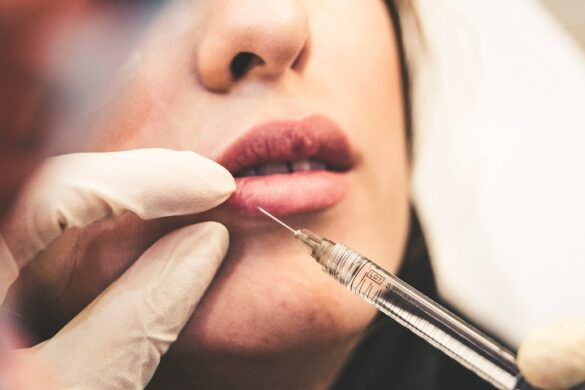 Risks of getting cheap Filler and Botox